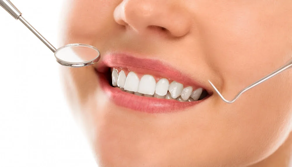 Dicas para a manutenção bucal correta da sua lente de contato dental 1 lentes de contato dente